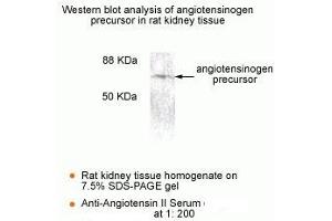 Angiotensin II anticorps