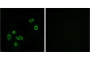 Image no. 3 for anti-Brain Protein 44-Like (BRP44L) (AA 11-60) antibody (ABIN1534701)