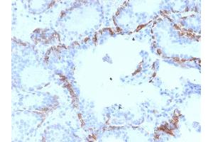 Image no. 6 for anti-Keratin 6A (KRT6A) antibody (ABIN6939867)