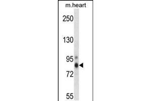 Image no. 1 for anti-Protein Kinase C, eta (PRKCH) (AA 314-341) antibody (ABIN5531849)