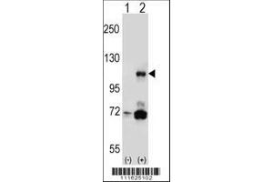 Image no. 3 for anti-Phosphoinositide-3-Kinase, Catalytic, beta Polypeptide (PIK3CB) (AA 124-154), (N-Term) antibody (ABIN652426)
