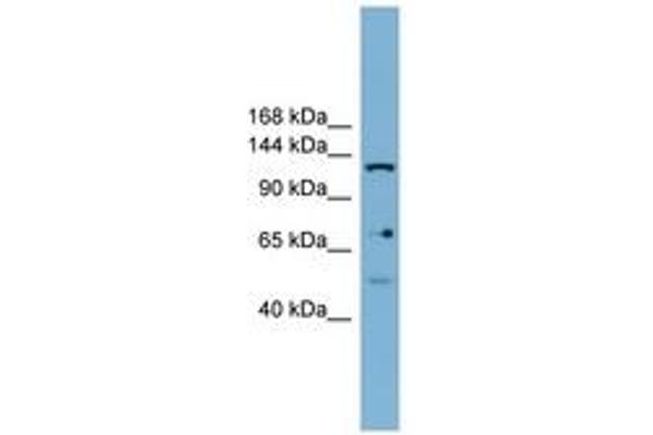 anti-Valyl-tRNA Synthetase 2, Mitochondrial (VARS2) (AA 899-948) antibody