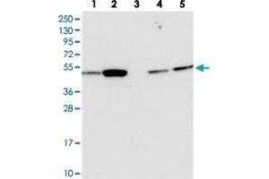 Image no. 1 for anti-Activating Transcription Factor 7 Interacting Protein 2 (ATF7IP2) antibody (ABIN5573106)