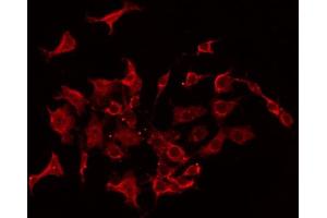 Image no. 3 for anti-Stathmin 1 (STMN1) (pSer38) antibody (ABIN6255270)