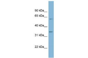 Image no. 1 for anti-O-Sialoglycoprotein Endopeptidase (OSGEP) (Middle Region) antibody (ABIN2787032)