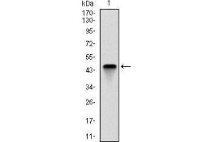Image no. 4 for anti-Fast Skeletal Troponin I (TNNI2) antibody (ABIN969572)