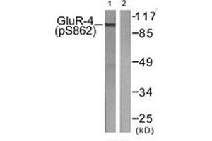 Western blot analysis of extracts from HepG2 cells treated with Forskolin 40nM 30', using GluR4 (Phospho-Ser862) Antibody.