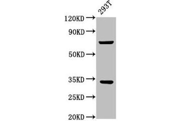 SLC25A5 Antikörper  (AA 144-175)