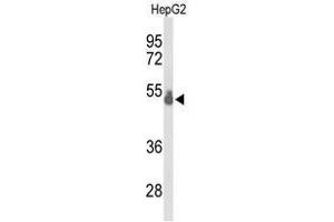 Image no. 2 for anti-T-Box 1 (TBX1) (AA 334-364), (C-Term) antibody (ABIN955110)