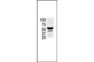 Image no. 1 for anti-P21-Activated Kinase 2 (PAK2) (AA 192-222), (N-Term) antibody (ABIN392433)