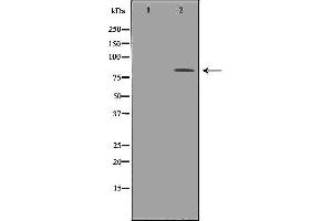 Image no. 2 for anti-Tumor Protein P63 (TP63) antibody (ABIN6265681)