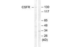 Image no. 3 for anti-Colony Stimulating Factor 1 Receptor (CSF1R) (AA 781-830) antibody (ABIN1532577)