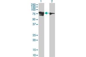 Image no. 1 for anti-Runt-Related Transcription Factor 1, Translocated To, 1 (Cyclin D-Related) (RUNX1T1) (AA 416-525) antibody (ABIN560190)