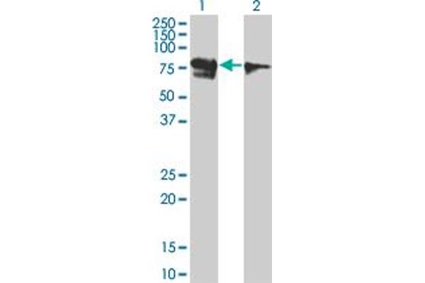 anti-Runt-Related Transcription Factor 1, Translocated To, 1 (Cyclin D-Related) (RUNX1T1) (AA 416-525) antibody