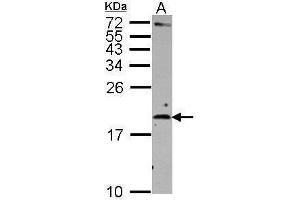 WB Image Sample (30 ug of whole cell lysate) A: Raji 15% SDS PAGE antibody diluted at 1:500