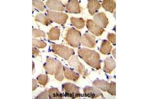 Image no. 1 for anti-ADP-Ribosylation Factor-Like 17A (ARL17A) (AA 109-139), (Middle Region) antibody (ABIN950501)