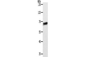 Image no. 2 for anti-ATP-Binding Cassette, Sub-Family D (Ald), Member 4 (ABCD4) antibody (ABIN2426497)