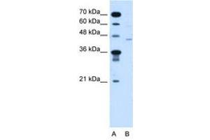 Fukutin antibody  (AA 111-160)