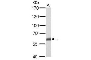 Image no. 4 for anti-T-Complex 1 (TCP1) (Internal Region) antibody (ABIN2855394)