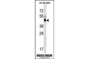 Image no. 1 for anti-Protein Phosphatase 1, Regulatory Subunit 7 (PPP1R7) (AA 312-340), (C-Term) antibody (ABIN1537114)