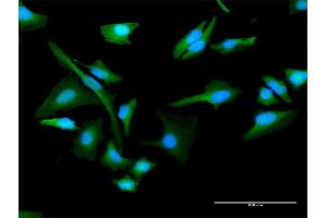 Immunofluorescence of purified MaxPab antibody to CHKA on HeLa cell.