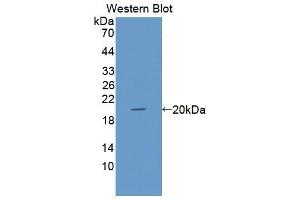 Image no. 4 for anti-Keratin 12 (KRT12) (AA 398-456) antibody (ABIN1173047)