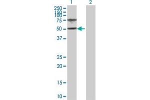Image no. 1 for anti-Homogentisate 1,2-Dioxygenase (HGD) (AA 1-445) antibody (ABIN516420)