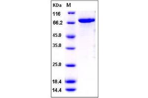 Image no. 1 for CDC42 Binding Protein Kinase beta (DMPK-Like) (CDC42BPB) (AA 1-427) protein (GST tag,His tag) (ABIN2004341)