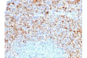 CD40 Ligand antibody  (AA 108-261)
