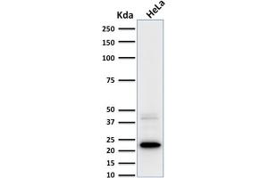 Image no. 1 for anti-Ferritin, Light Polypeptide (FTL) (AA 38-165) antibody (ABIN6939459)