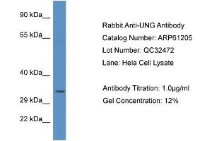 Image no. 1 for anti-Uracil-DNA Glycosylase (UNG) (C-Term) antibody (ABIN2788718)