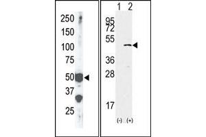 Image no. 2 for anti-SET Domain Containing (Lysine Methyltransferase) 7 (SETD7) (Middle Region) antibody (ABIN356694)