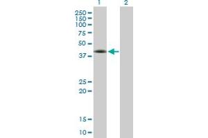 Image no. 1 for anti-FOS-Like Antigen 2 (FOSL2) (AA 1-326) antibody (ABIN515797)