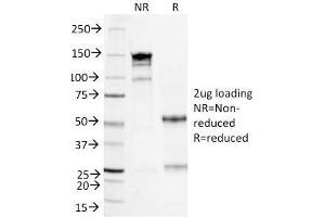Image no. 1 for anti-Serum Amyloid A (SAA) antibody (ABIN6940562)
