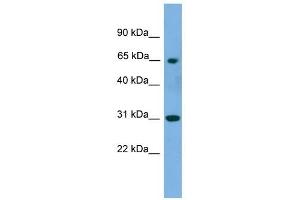 Image no. 1 for anti-Polynucleotide Kinase 3'-Phosphatase (PNKP) (Middle Region) antibody (ABIN633051)