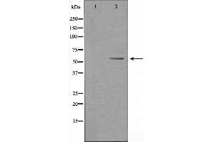 Image no. 1 for anti-6-phosphofructo-2-Kinase/fructose-2,6-Biphosphatase 2 (PFKFB2) (C-Term) antibody (ABIN6257913)