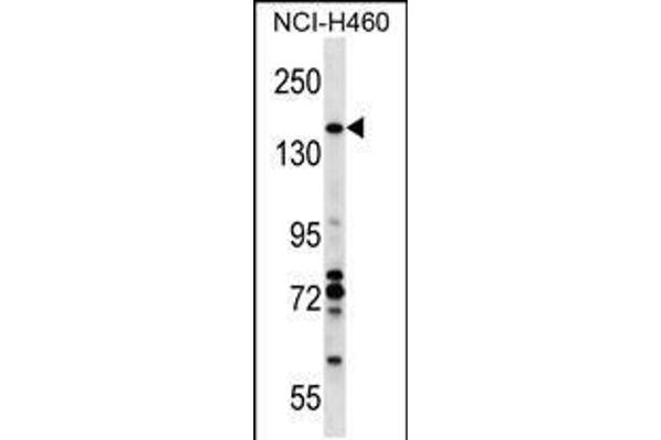 anti-Valosin Containing Protein (p97)/p47 Complex Interacting Protein 1 (Vcpip1) (AA 124-151), (N-Term) antibody