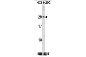 Image no. 1 for anti-Major Histocompatibility Complex, Class II, DQ alpha 2 (HLA-DQA2) (AA 39-66) antibody (ABIN1881421)