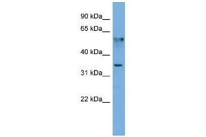 Image no. 2 for anti-Fibronectin Type III Domain Containing 8 (FNDC8) (N-Term) antibody (ABIN2774171)