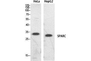 Image no. 2 for anti-Secreted Protein, Acidic, Cysteine-Rich (Osteonectin) (SPARC) (Internal Region) antibody (ABIN3187993)