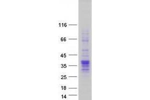 Image no. 1 for Vestigial Like 4 (VGLL4) (Transcript Variant 1) protein (Myc-DYKDDDDK Tag) (ABIN2735254)