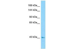 anti-Centrosomal Protein 120kDa (CEP120) (N-Term) antibody