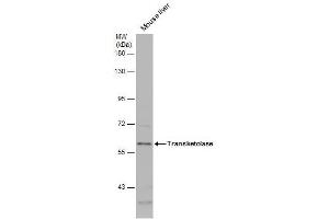 Image no. 3 for anti-Transketolase (TKT) (Internal Region) antibody (ABIN2855058)