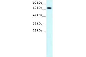 Image no. 2 for anti-Protein Inhibitor of Activated STAT, 3 (PIAS3) (C-Term) antibody (ABIN2777574)