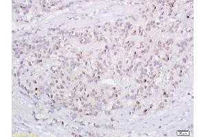 Image no. 1 for anti-Tumor Protein P73 (TP73) (AA 501-631) antibody (ABIN675279)