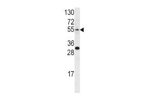 Image no. 2 for anti-Endothelin Receptor Type A (EDNRA) antibody (ABIN2158634)