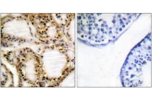 Image no. 1 for anti-Retinoblastoma Protein (Rb Protein) (AA 791-840), (pThr821) antibody (ABIN1531516)