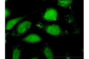 Immunofluorescence of purified MaxPab antibody to CCL27 on HeLa cell.