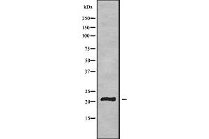 Image no. 3 for anti-Transmembrane Protein 37 (TMEM37) (N-Term) antibody (ABIN6265613)