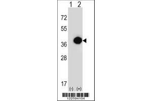 Image no. 2 for anti-Phytanoyl-CoA 2-Hydroxylase (PHYH) (AA 59-87), (N-Term) antibody (ABIN652656)